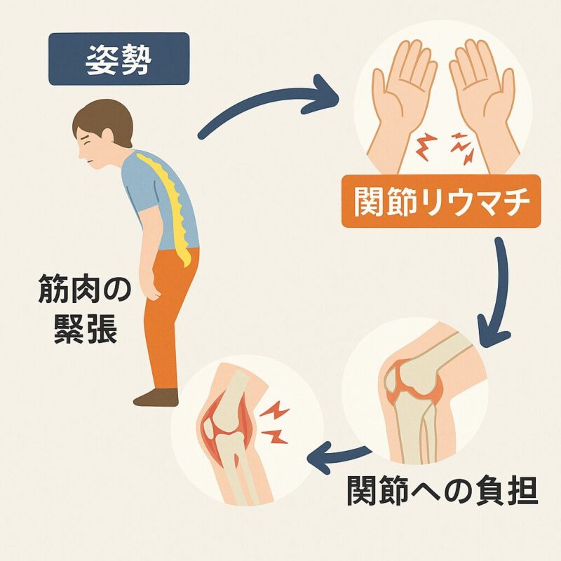 姿勢関節リュウマチ