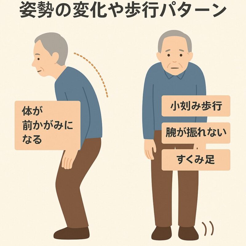 姿勢の変化や歩行パターン